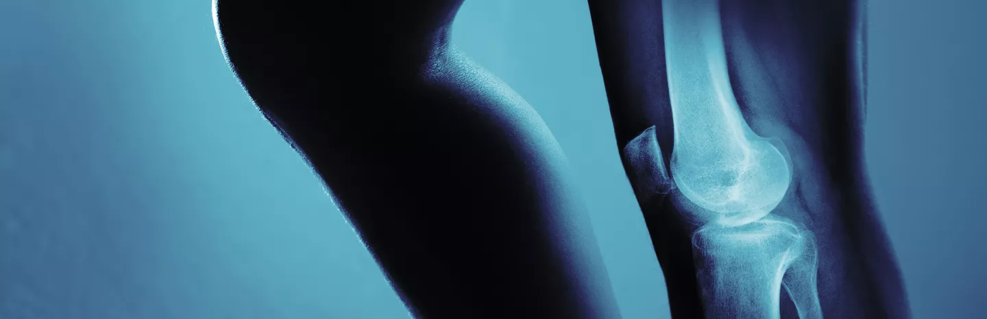 x-ray of a human knee