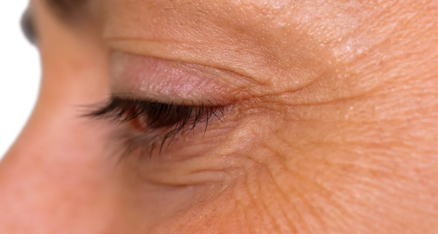 Extreme close-up of a person's face and eye showing crow's feet wrinkles