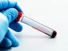 gloved hand holding a vial of blood