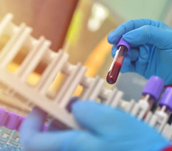 Lab sample testing; laboratory-developed tests (LDTs) are unregulated by FDA, leading to unreliable results and the risks of false positives or negatives.