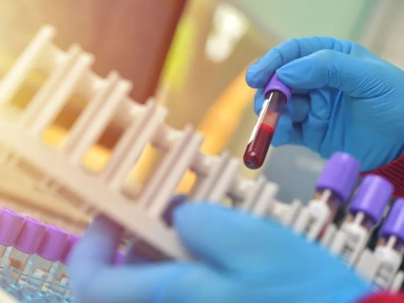 Lab sample testing; laboratory-developed tests (LDTs) are unregulated by FDA, leading to unreliable results and the risks of false positives or negatives.