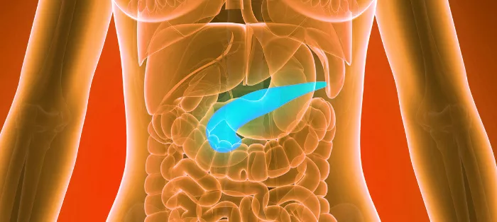 pancreatic cancer