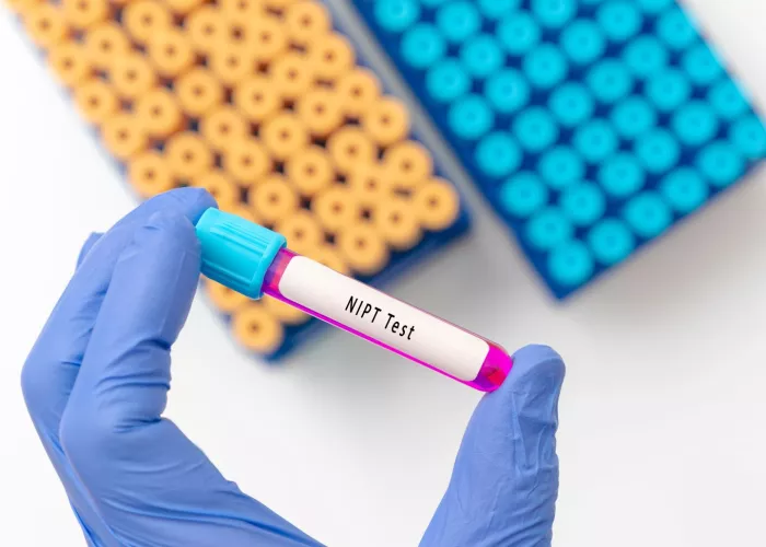 A gloved hand holds a laboratory test tube labeled NIPT Test - non-invasive prenatal testing. In the background are additional test tubes with yellow and blue caps. 