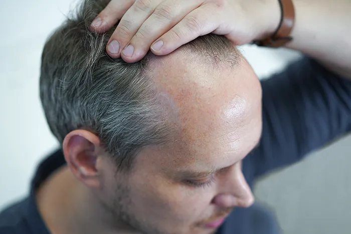 man pulling back his grey hair 