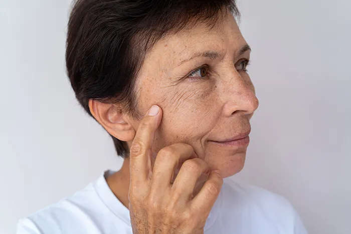 older woman pointing to fine lines and wrinkles on her face