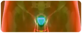 colorful diagram of the prostate