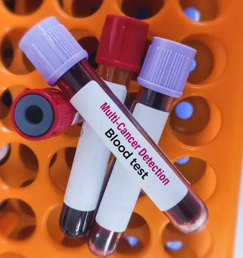 3 blood vials laying on orange vial stands