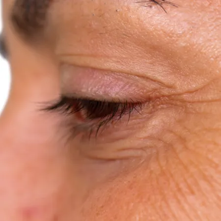 close up of person's eye in profile