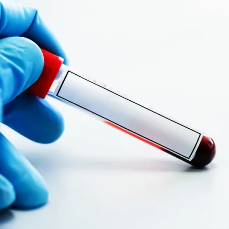 gloved hand holding a vial of blood